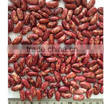 high quality heanlthy Red speckled kidney beans