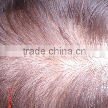 most natural Injected Lace Hair Piece