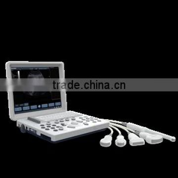 Hot selling medical diagnostic equipment with high quality