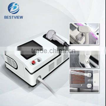Diode Laser Permanent Unwanted Hair Hair Removal Permanent Cost Back / Whisker