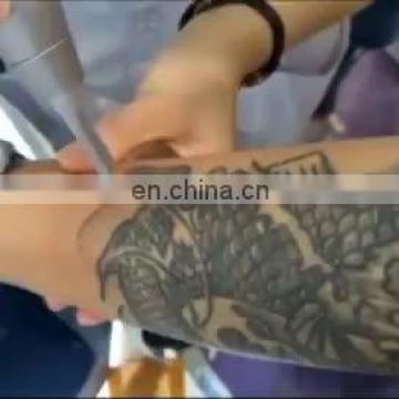 Tattoo removal laser machine china laser / picosecond laser machine