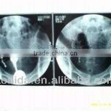 mammography film,image very hot,dry xray films