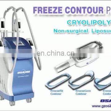 Freeze Contour Plus fat freezing 4 handle simultaneous criolipolysis machine germany