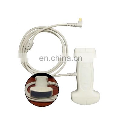 Ultrasound Machine Dual Head for Android usb ultrasound linear probe price