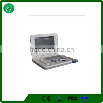 Full Digital Laptop B Mode Ultrasound Scanner for Clinical examination and diagnosis