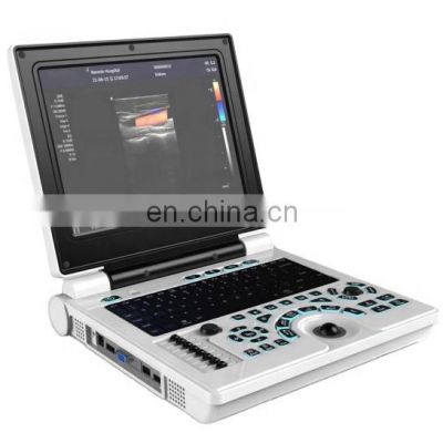 High quality laptop color doppler medical ultrasound scanner for hospital use