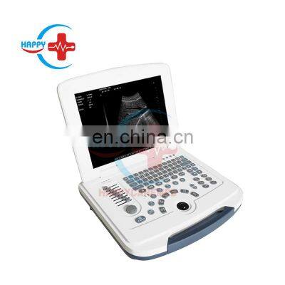 HC-A003 Black and White Full digital laptop ultrasound machine with 12 inch HD LCD Display