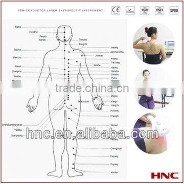 portable free shipping 808nm cold laser device tympanitis treatment Chinese acupuncture healthcare equipment