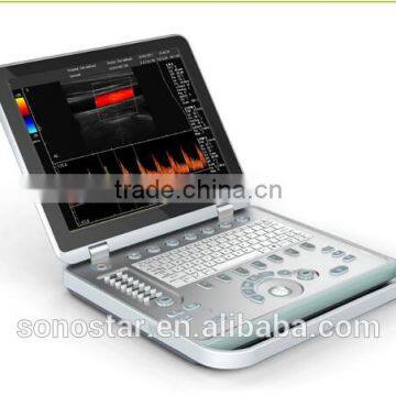 2014 very popular 3D Doppler color ultrasound scanner for blood flow scanning