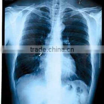 medical x ray film, fuji x ray film of equipment accessories