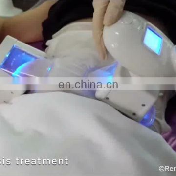 Renlang Remove Double Chin Fat Freezing Slimming Vertical Machine Salon Use