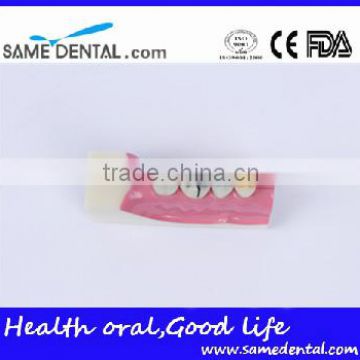 Right Tooth Tissue Decomposition Model Dental Eduction Assitant No. DEA-17