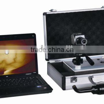 TR5000 CSeries Infrared Mammary Tester(laptop one)
