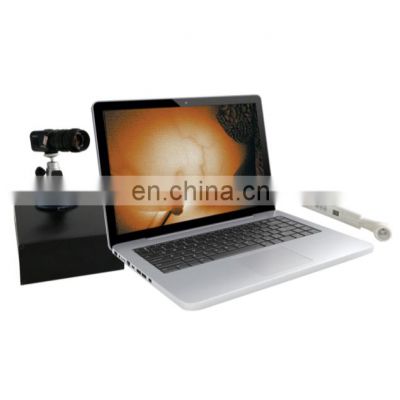 High quality infrared detection breast disease diagnosis machine for Breast Detection