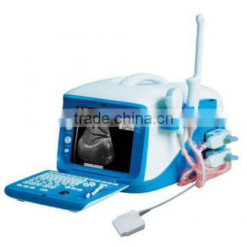 Full digital portable ultrasound scanner WT-6000