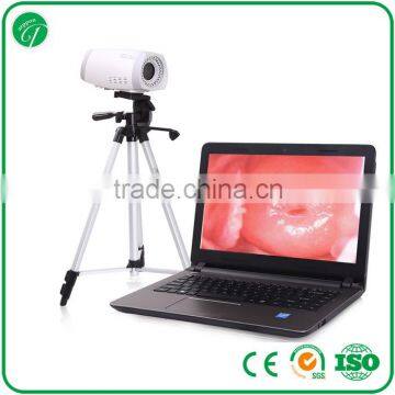 gynaecology diagnostic equipment/vagina examination/video colposcope manufacturer in China