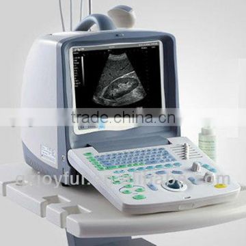 portable type EM-2000 ultrasound scan machine with 2 probes