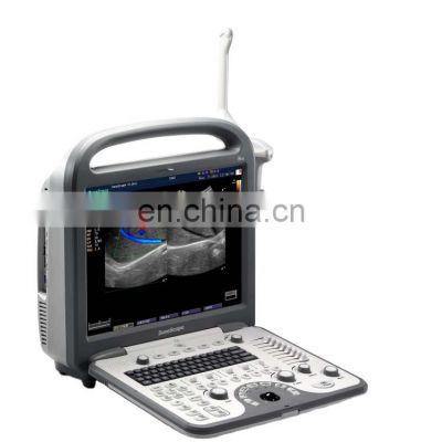 Sonoscape S8 Portable color doppler ultrasound sys for hospital