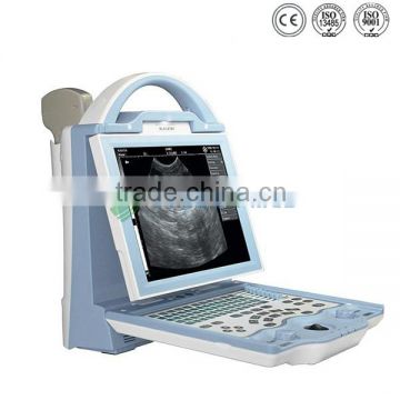 YSB5600V low price high quality imaging full digital portable vet B ultrasound scanner