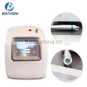 High quality intelligent operation spider vein removal machine 30w diode laser 980nm with CE certification