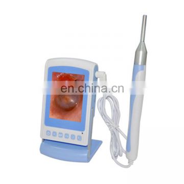 MY-G044C-N ent medical devices portable digital ear otoscope camera otoscope video