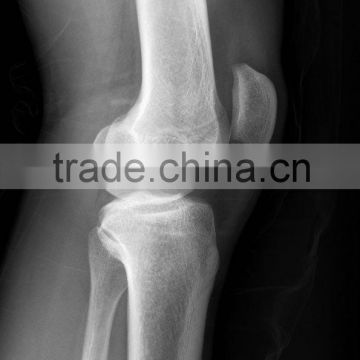 China agfa x-ray film CE KND-F/A