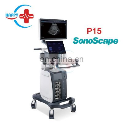 New Innovative Color doppler ultrasound /Sonoscape ultrasound p15 /Ultrasound scanner machine