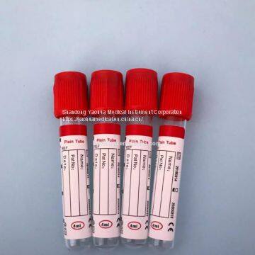 Plain blood tube red top blood test tube