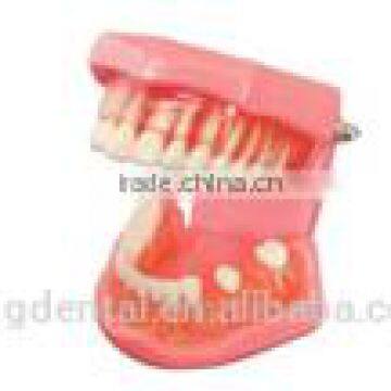 Natural size model (removable) I study model Hot Sale Human Dental Teaching Models AC-P34