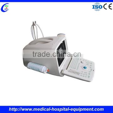 Portable Ultrasound Price