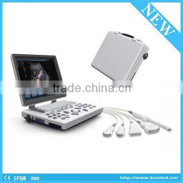 Portable echography machine/4D laptop ultrasound scanner