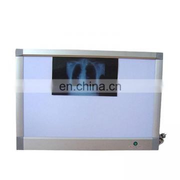 MA1149 100% China original high quality medical x ray film viewer and x-ray film