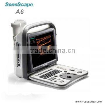 portable famous brand ultrasound machine SonoScape A6