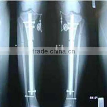 medical x-ray film, x-ray blue film from zhejiang hangzhou