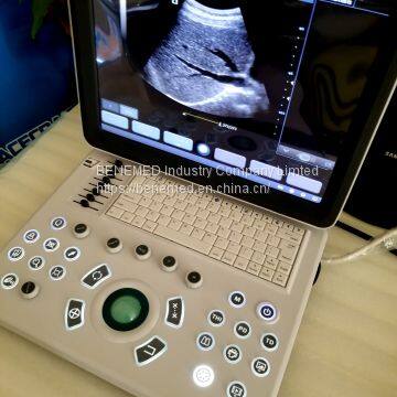 Ultraslim Notebook Type Black and White Ultrasound Scanner Machine Bw-8