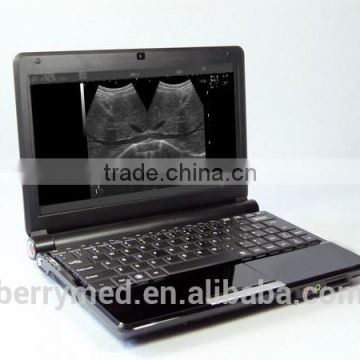 laptop patient care hospital B Mode Ultrosound Scaner scanner machine 7.5MHz probe