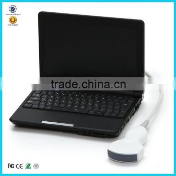 2016 CE Cheapest Price Large Screen Good Image Laptop Ultrasound Scanner Machine with Convex,Linear, Vaginal Tranducer-RUS-9000F