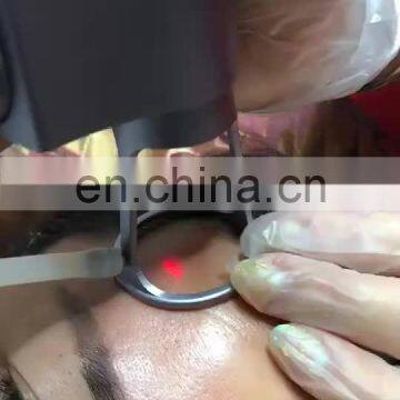 laser diode 808/ hair removal diode laser machine /hair removal stardust 808 755 1064
