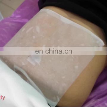 CE ISO ROHS approval cryolipolysis fat freeze slimming machine RENLANG