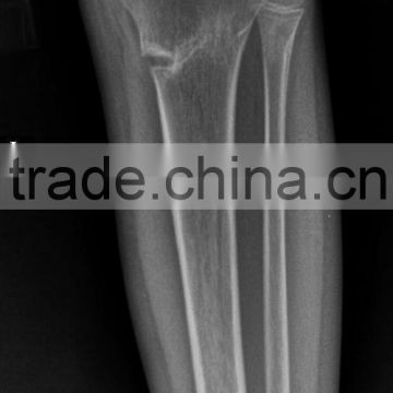 fuji medical x-ray film,x-ray blue film, china wholesale CT/MRI/DR/CR/DSA film