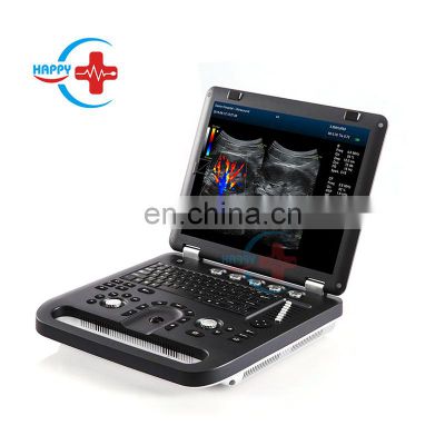 HC-A013A Cheap price  medical Laptop Color Doppler Ultrasonic Diagnostic System portable color doppler ultrasound