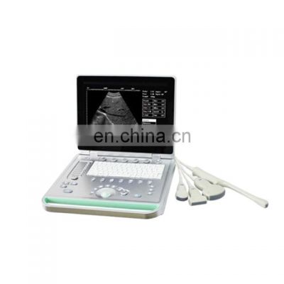 Sales New style advanced configuration with one  host/convex/probe aluminum trunk laptop body B ultrasound scanner