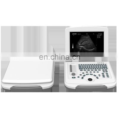 Factory Competitive Price of Ultrasound scanner Medical Equipment laptop portable ultrasound machine system