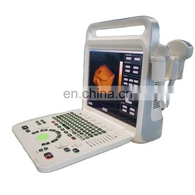 Hot sale  Portable 15 inch 2d 3d 4d Color Doppler Ultrasound Scanning Machine for hospital use