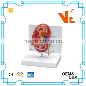 V-AM035 The dissection model of kidney and cyst