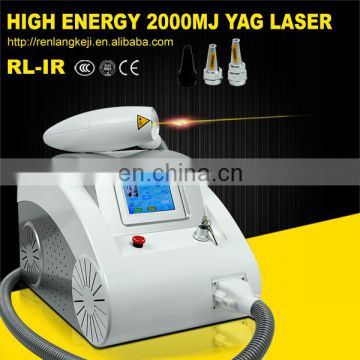 Professional Q-swich nd yag laser tattoo removal machine/ 1064nm 532nm 1320nm q switch nd yag beauty machine