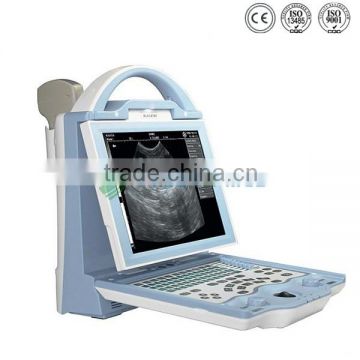 2016 Quality Digital Portabl Veterinary Ultrasound Equipment