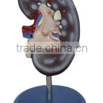 kidney model,organ model