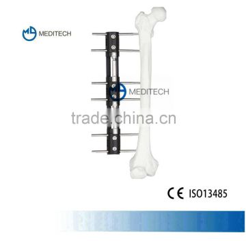 Bone Lengthening External Fixation orthopedic surgical instruments Type A