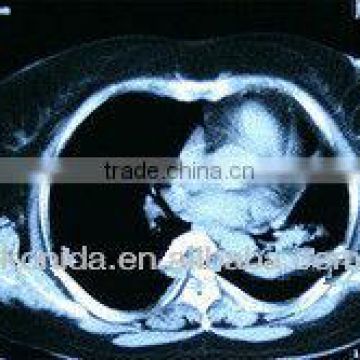 x ray radiography,knd,x-ray accessory equipment